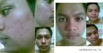 NIMs Day Cream มัลติ โพรเทคชั่น เดย์ ครีมคุณภาพสูง บำรุงและปกป้องผิวกลางวัน SPF50 / PA+++