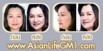 BIM100  ลาดพร้าว Gold Shape Face Slimsafe ผู้มีปัญหาส่วนเกิน กระชับผิวบริเวณลำคอ คางและแก้ม