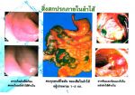 ชา วิน ที 4 ซองลดน้ำหนักได้ 1 กก. ลดหน้าท้องได้ 1 นิ้ว จริง