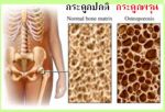 วินแคลริช(WIN CALRICH)ผลิตภัณฑ์เสริมแคลเซียม