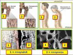 วินแคลริช(WIN CALRICH)ผลิตภัณฑ์เสริมแคลเซียม