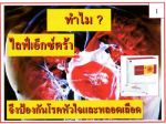 โรคหัวใจ แก้ปัญหาได้ด้วย ไลฟ์เอ็กซ์ตร้า(Livextra)