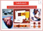 โรคหัวใจ แก้ปัญหาได้ด้วย ไลฟ์เอ็กซ์ตร้า(Livextra)