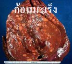 ทูมอริด แคปซูล  Tumorid Capsule โรคมะเร็ง