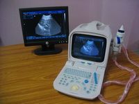 ultrasound