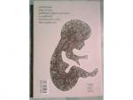 ก้อนเนื้อ MISCARRY/by lady nove