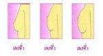 ฮอร์โมนอกอึ๋ม สินค้านำเข้า ของแท้ 100%