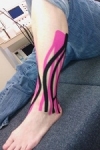 Kinesio Tex Gold คิเนซิโอเท็กซ์โกลด์ ผ้าเทปเพื่อการบำบัด