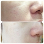 Cle' Miracle clay mask 30g