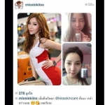 Kiss Skincare