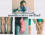 ถุงเท้าที่ถักทอด้วยเส้นใยบำบัดอัจฉริยะเพื่อสุขภาพและสรีระที่งดงาม ถุงเท้าที่ถักทอด้วยเส้นใยบำบัดอัจฉริยะเพื่อสุขภาพและสรีระที่งดงาม