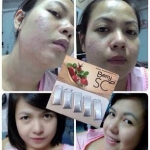 สเตมเซลล์ Berry SC สารสกัดจากผลเบอรรี่