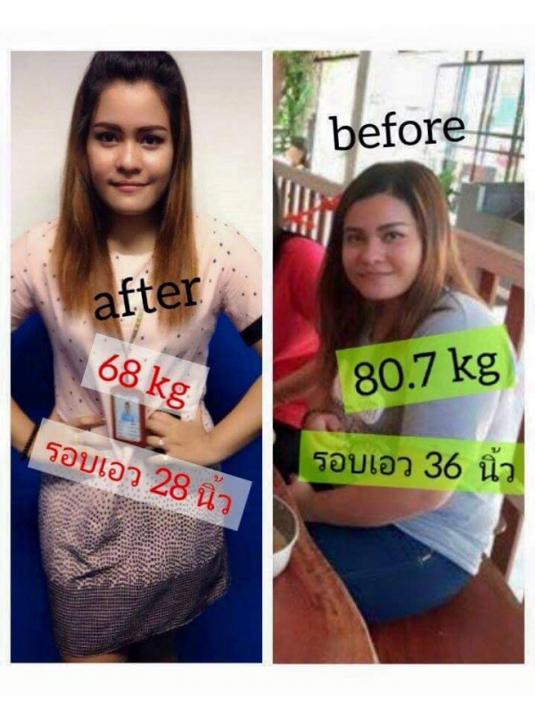 ลดน้ำหนักขั้นเทพBy slim clinic