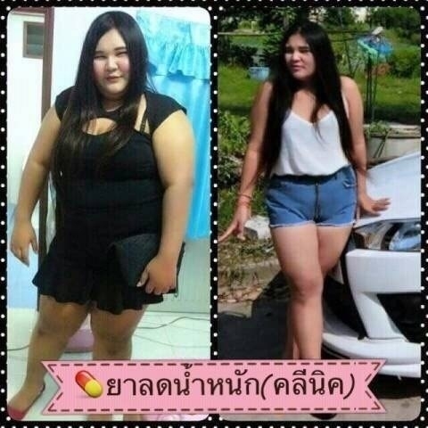 ลดน้ำหนัก2-5kgต่อสัปดาห์ ลดน้ำหนัก2-5kgต่อสัปดาห์